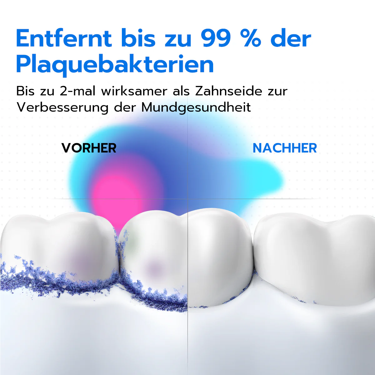 usmile C10 Tragbare Munddusche - Image 4
