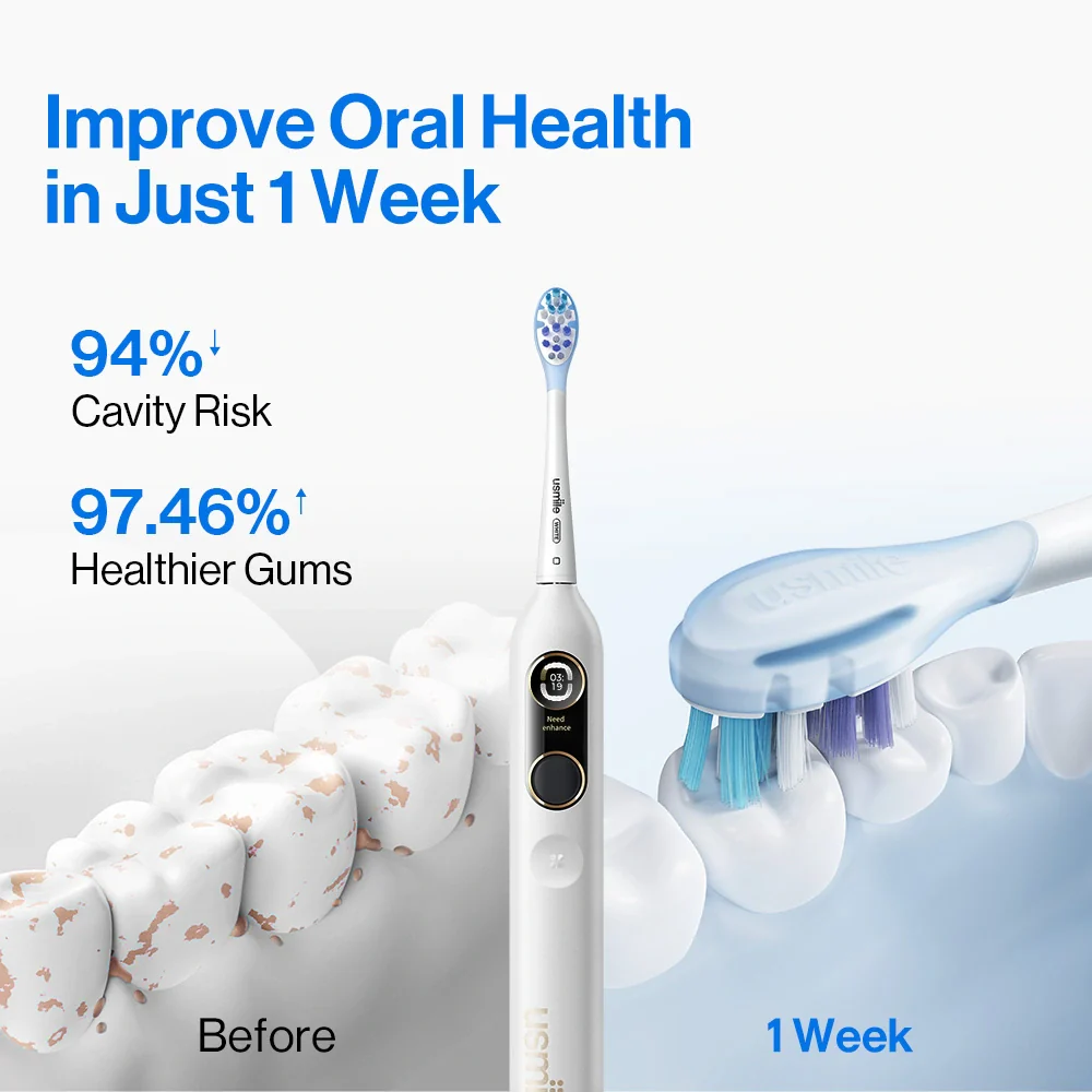 usmile Y10 PRO Electric Toothbrush with Missed Spots Guidance - Image 4