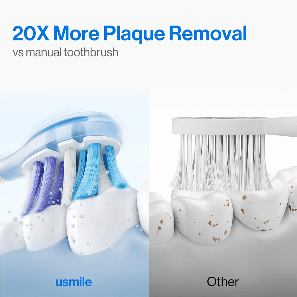 usmile Y10 PRO Electric Toothbrush with Missed Spots Guidance - Image 5
